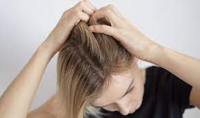 <strong>How To Deal With Dandruff it treatment and care</strong>